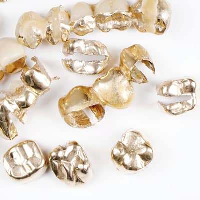Various pieces of yellow dental gold crowns and bridges